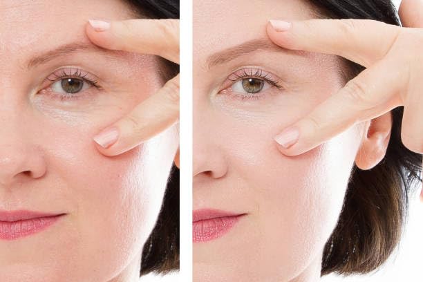 Navensi Bakuchiol Serum