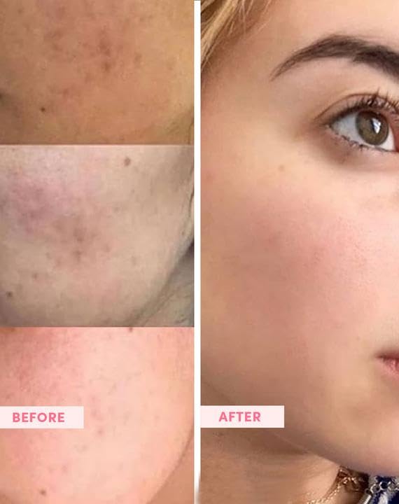 Navensi Bakuchiol Serum