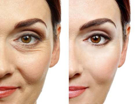 Navensi Bakuchiol Serum