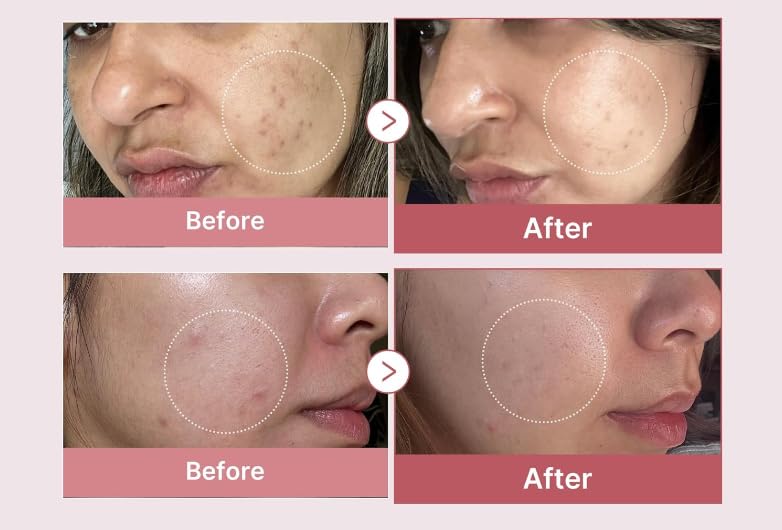Navensi Bakuchiol Serum