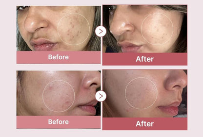 Navensi Bakuchiol Serum