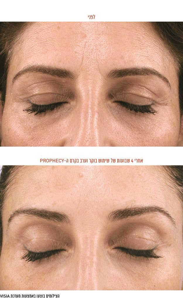 Navensi Bakuchiol Serum